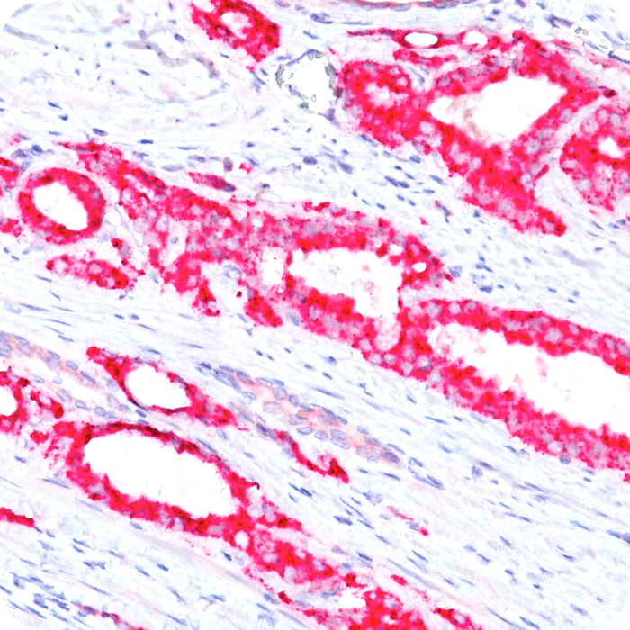 AMACR / p504S (Prostate Cancer Marker); Clone 13H4 (Concentrate)