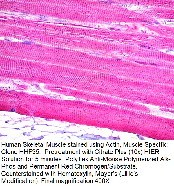 Actin, Muscle Specific (Muscle Cell Marker); Clone HHF35 (Concentrate)