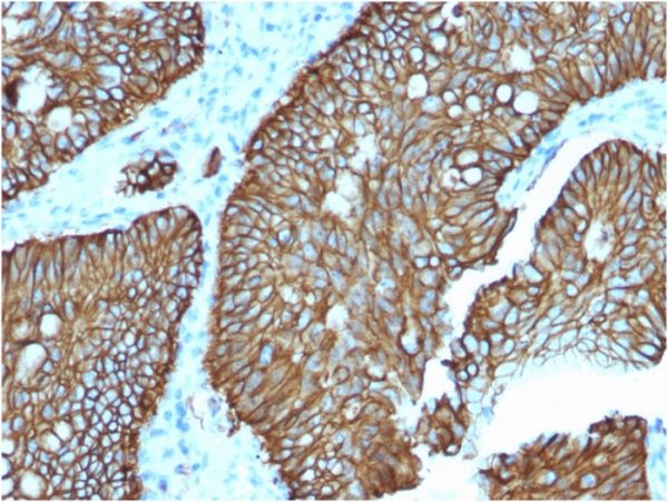 Cadherin 17 / LI Cadherin (Liver-Intestine Marker); Clone CDH17/2618