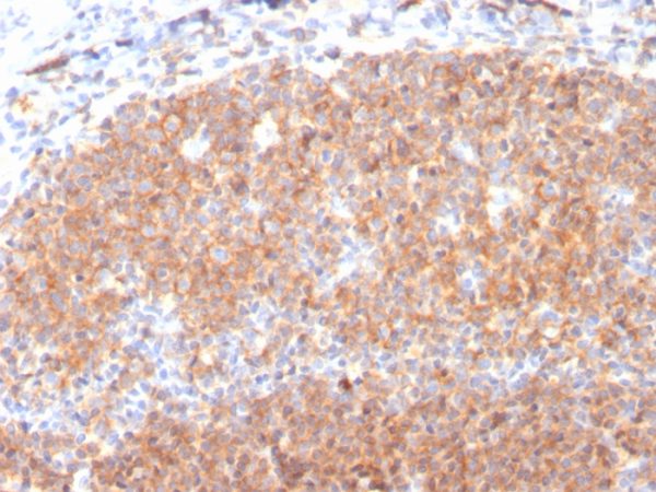 CD19 (B-Lymphocyte Marker); Clone CD19/3117