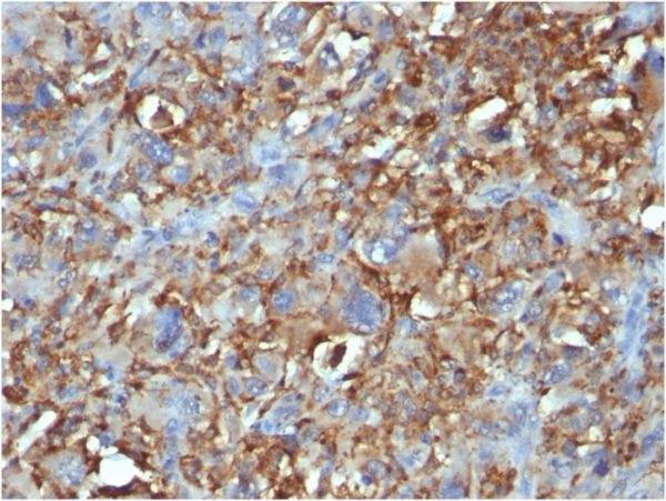 CD68 (Macrophage Marker); Clone C68/684