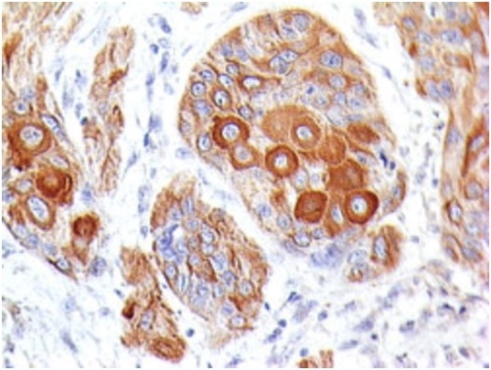 CD86 (Dendritic Cells Maturation Marker); Clone BU63