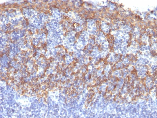 Cytokeratin 14 (KRT14) (Squamous Cell Marker); Clone LL002