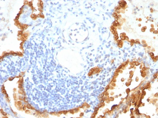 Cytokeratin 8/18; Clone KRT8/803 + KRT18/835