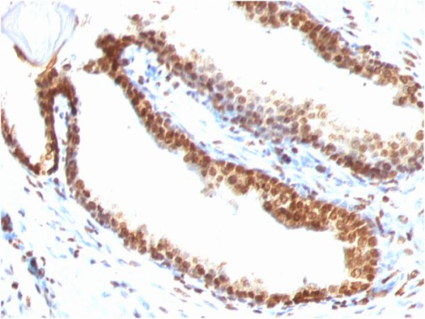 Double Stranded DNA (dsDNA) (Nuclear Marker); Clone DSD/958