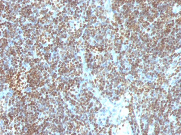 Double Stranded DNA (dsDNA) (Nuclear Marker); Clone SPM603