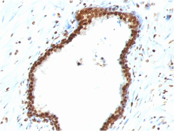 Double Stranded DNA (dsDNA) (Nuclear Marker); Clone 121-3