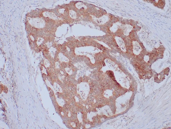 Ep-CAM / CD326 (Extracellular Domain) (Epithelial Marker); Clone Ber-EP4