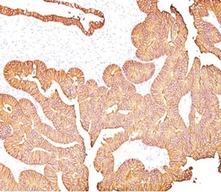 EpCAM / CD326 (Epithelial Marker); Clone 323/A3