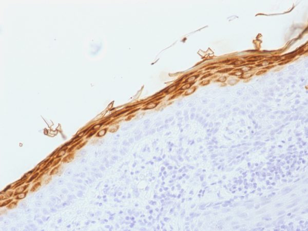 Filaggrin (Keratinocyte Differentiation Marker); Clone FLG/1562