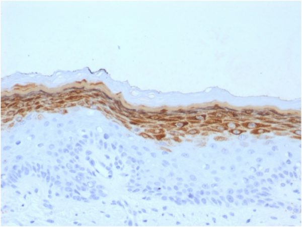 Filaggrin (Keratinocyte Differentiation Marker); Clone FLG/1561