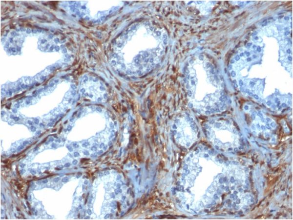 Galectin-1 / Human Placental Lactogen (hPL); Clone GAL1/1831