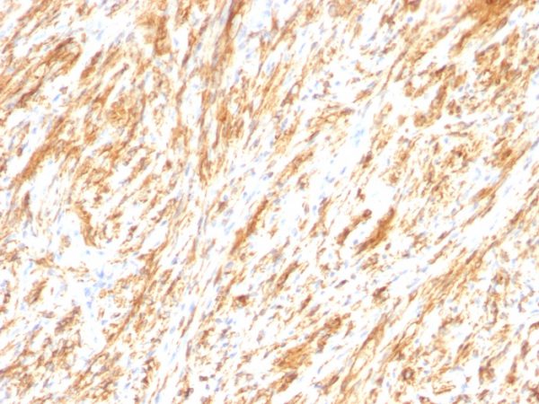 GFAP (Astrocyte & Neural Stem Cell Marker); Clone SPM248