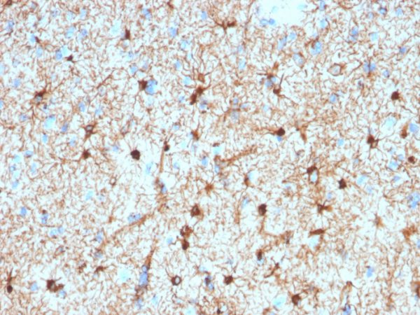 GFAP (Astrocyte & Neural Stem Cell Marker); Clone GFAP/2076