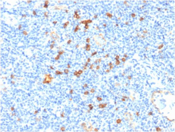 IL3RA / CD123 (Acute Myeloid Leukemia Marker); Clone IL3RA/1531