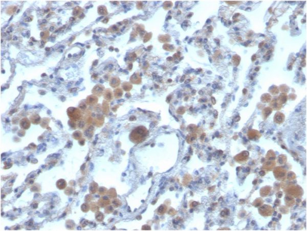 Ras-related C3 botulinum toxin substrate 1; Clone CPTC-RAC1-1