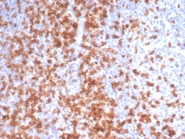 Recombinant CD3e (T-Cell Marker); Clone C3e/3125R