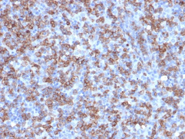 Recombinant CD8A (Cytotoxic- & Suppressor T-Cell Marker); Clone C8/1779R