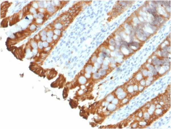 Recombinant Cytokeratin 8/18; Clone KRT8.18/2297R