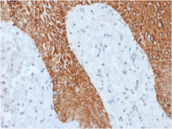 Recombinant Cytokeratin, Multi (Epithelial Marker); Clone KRT/1877R