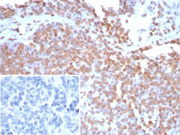 Recombinant Double Stranded DNA (dsDNA) (Nuclear Marker); Clone rDSD/8266