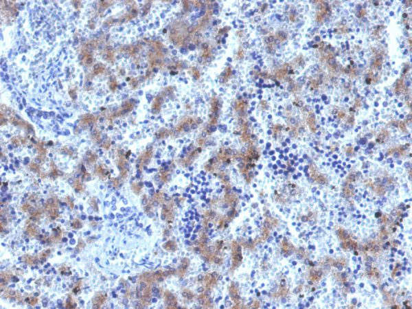 Recombinant Glypican-3 (GPC3) (Hepatocellular Carcinoma Marker); Clone GPC3/1534R