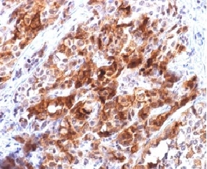 Recombinant Glypican-3 (GPC3) (Hepatocellular Carcinoma Marker); Clone rGPC3/863