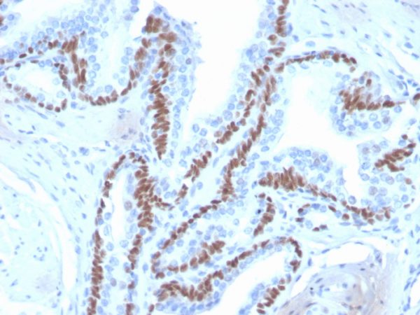 Recombinant p40 (deltaNp63) (Squamous, Basal & Myoepithelial Cell Marker); Clone ZR8