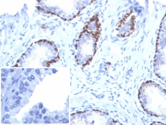 Recombinant p40 (Squamous, Basal & Myoepithelial Cell Marker); Clone P40/7302R