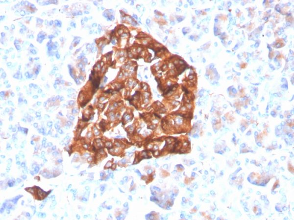 Recombinant Synaptophysin (Neuroendocrine Marker); Clone SYP/4503R (Concentrate)