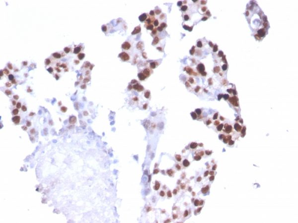 RNA Polymerase II; Clone CTD4H8