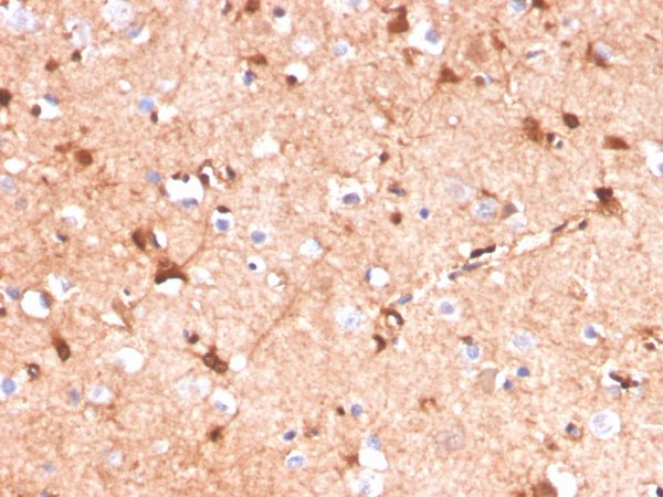 S100B (Astrocyte and Melanoma Marker); Clone S100B/4141