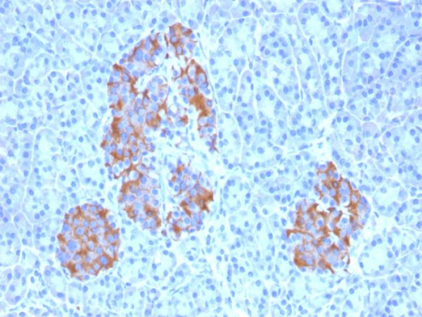 TNF-alpha (Tumor Necrosis Factor alpha); Clone TNFA/1172