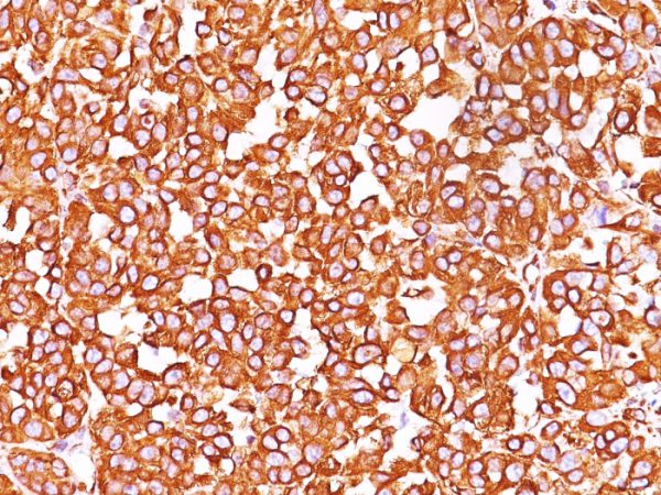 Vimentin (Mesenchymal Cell Marker); Clone SPM576