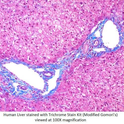 Trichrome Stain (Blue)