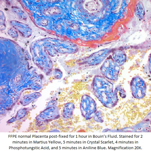 Martius Scarlet Blue (MSB) Stain Kit