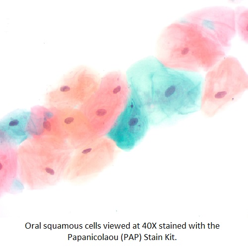 Squamous cells viewed with Papanicolaou (PAP) Stain Kit PAP smear gynecology stain