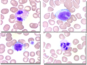 Blood smear stained with Quick-Dip Differential Stain Kit demonstrating various lymphocytes including; Eosinophil monocyte, lymphocyte, neutrophil